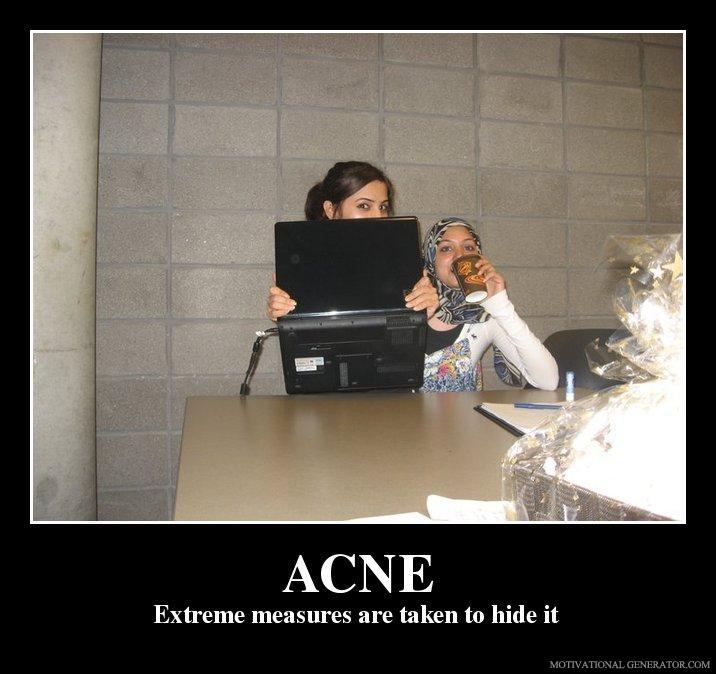 Acne extreme measures are taken to hide it 45e2d1